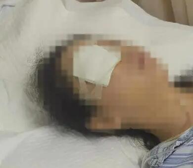 汽水瓶爆炸致女子眼球破裂 厂家回应 背后真相实在让人惊愕
