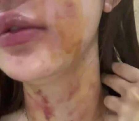 23岁女子自曝遭夫妻两人殴打扒衣 背后真相实在让人惊愕