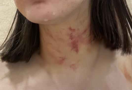 女子遭夫妻扒衣掐脖?警方介入 背后真相实在让人惊愕