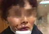 女子被狗撕碎左脸缝了500多针 背后真相实在让人惊愕