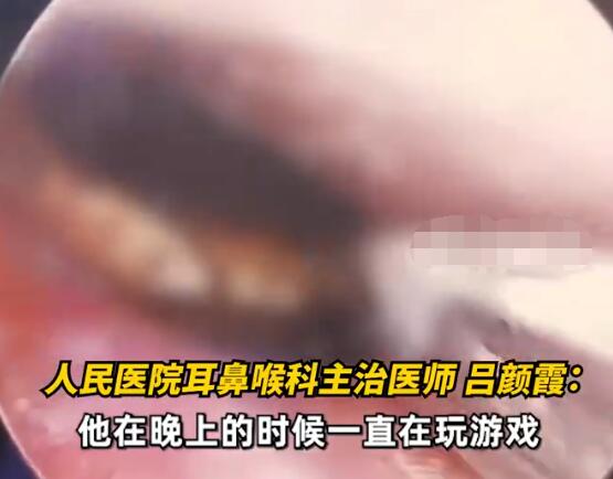男子半夜卧床玩手机蟑螂钻进耳朵 内幕曝光简直太意外了