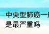 中央型肺癌一般能活多久  中央型肺癌是最严重吗