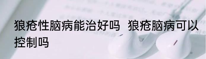 狼疮性脑病能治好吗  狼疮脑病可以控制吗