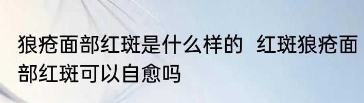 狼疮面部红斑是什么样的  红斑狼疮面部红斑可以自愈吗